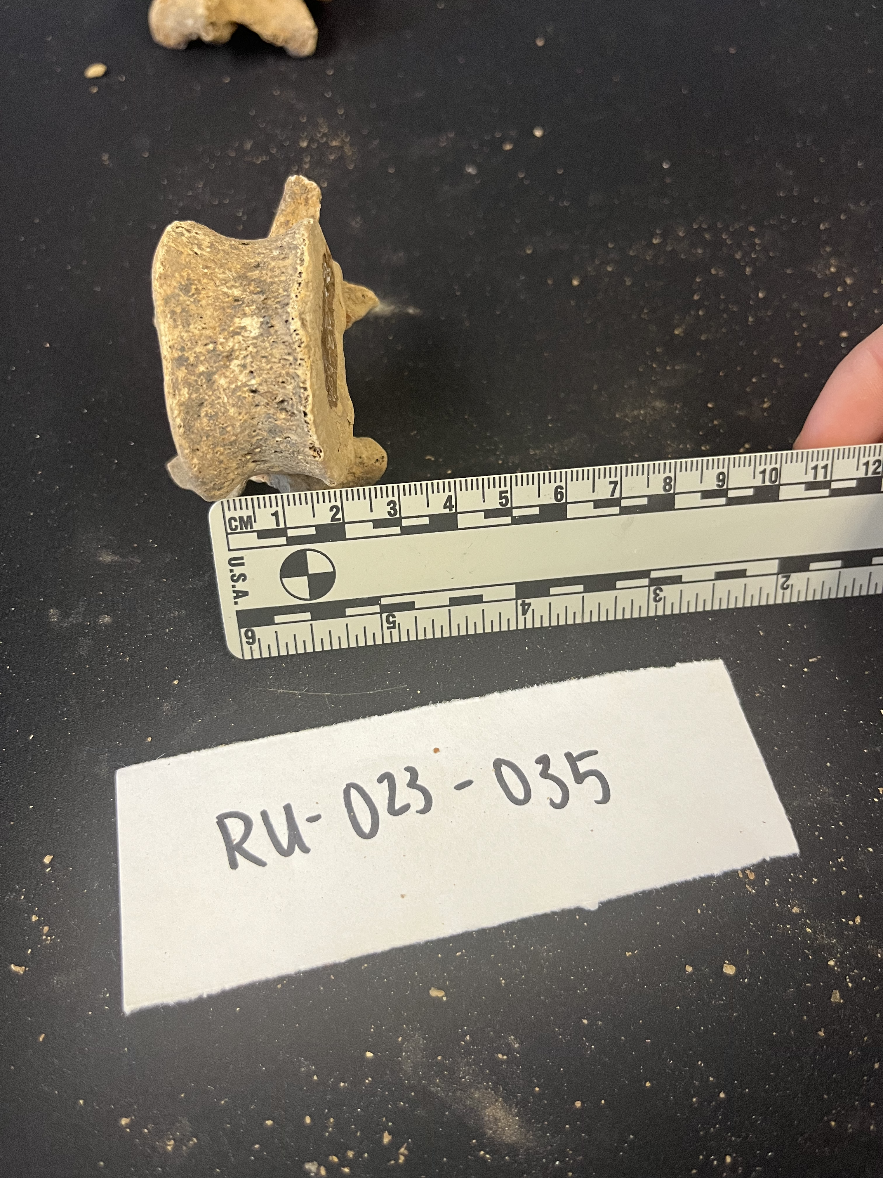 lumbar vertebrae lumbar vertebrae