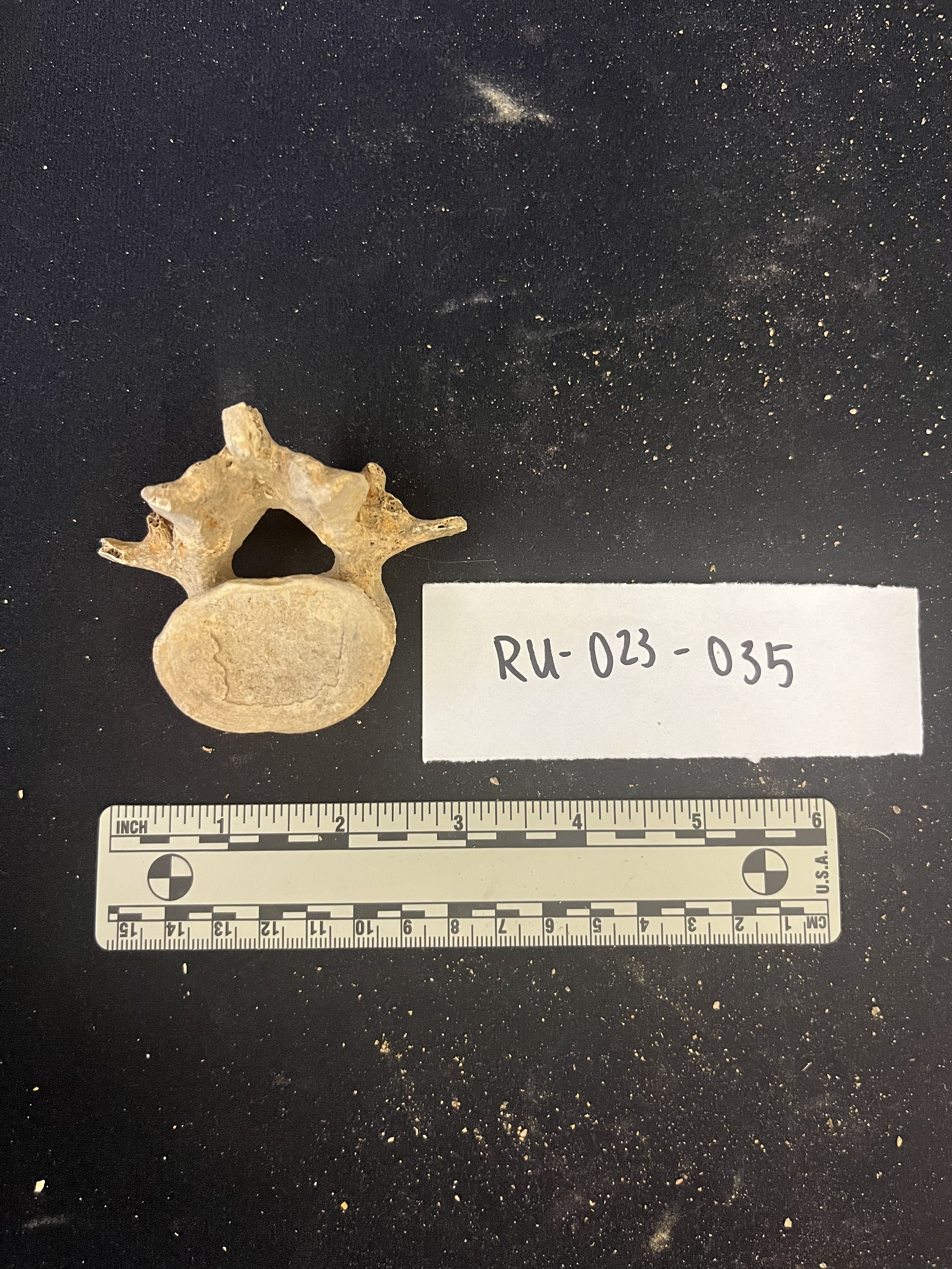 lumbar vertebrae lumbar vertebrae