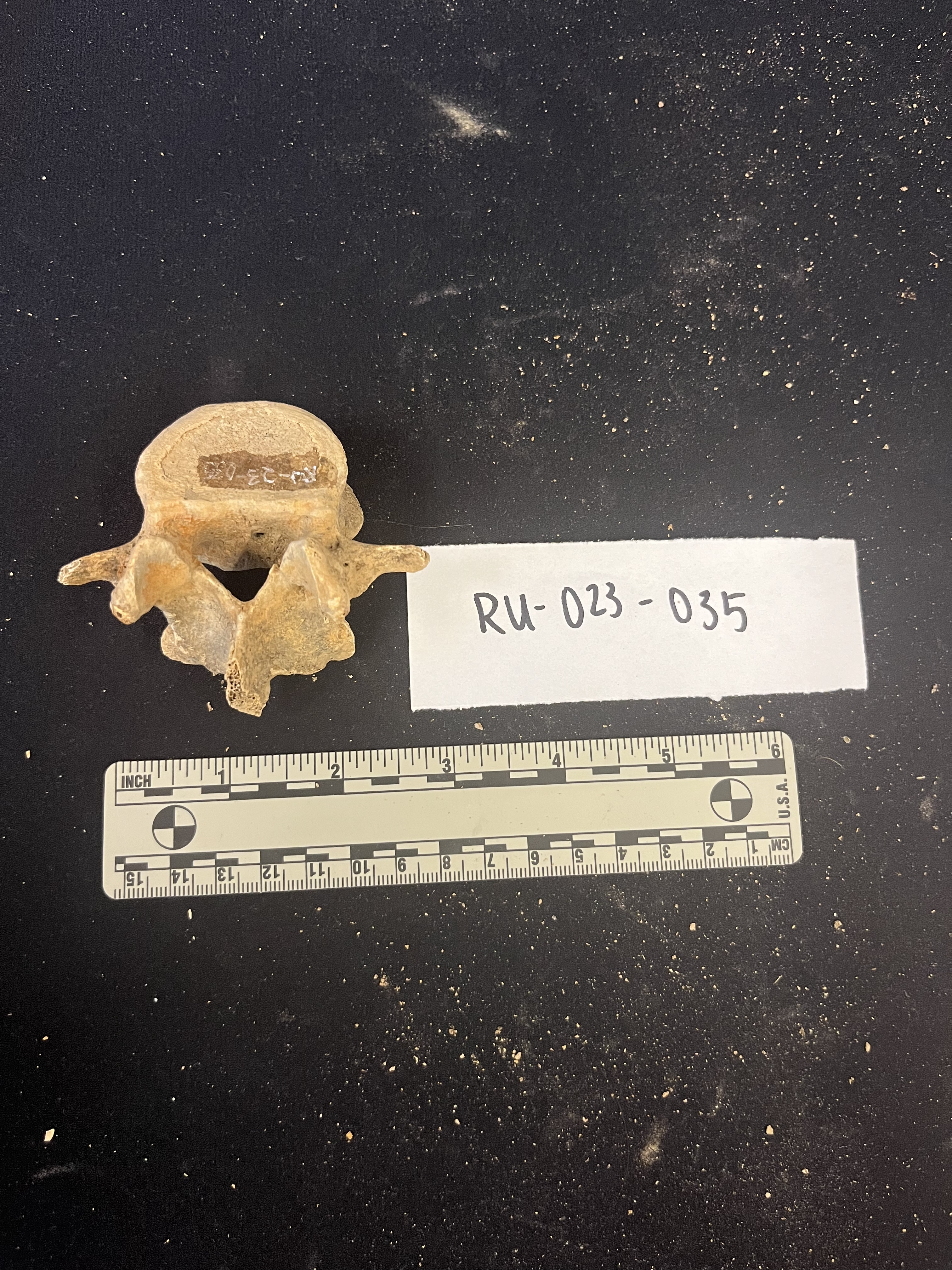 lumbar vertebrae lumbar vertebrae
