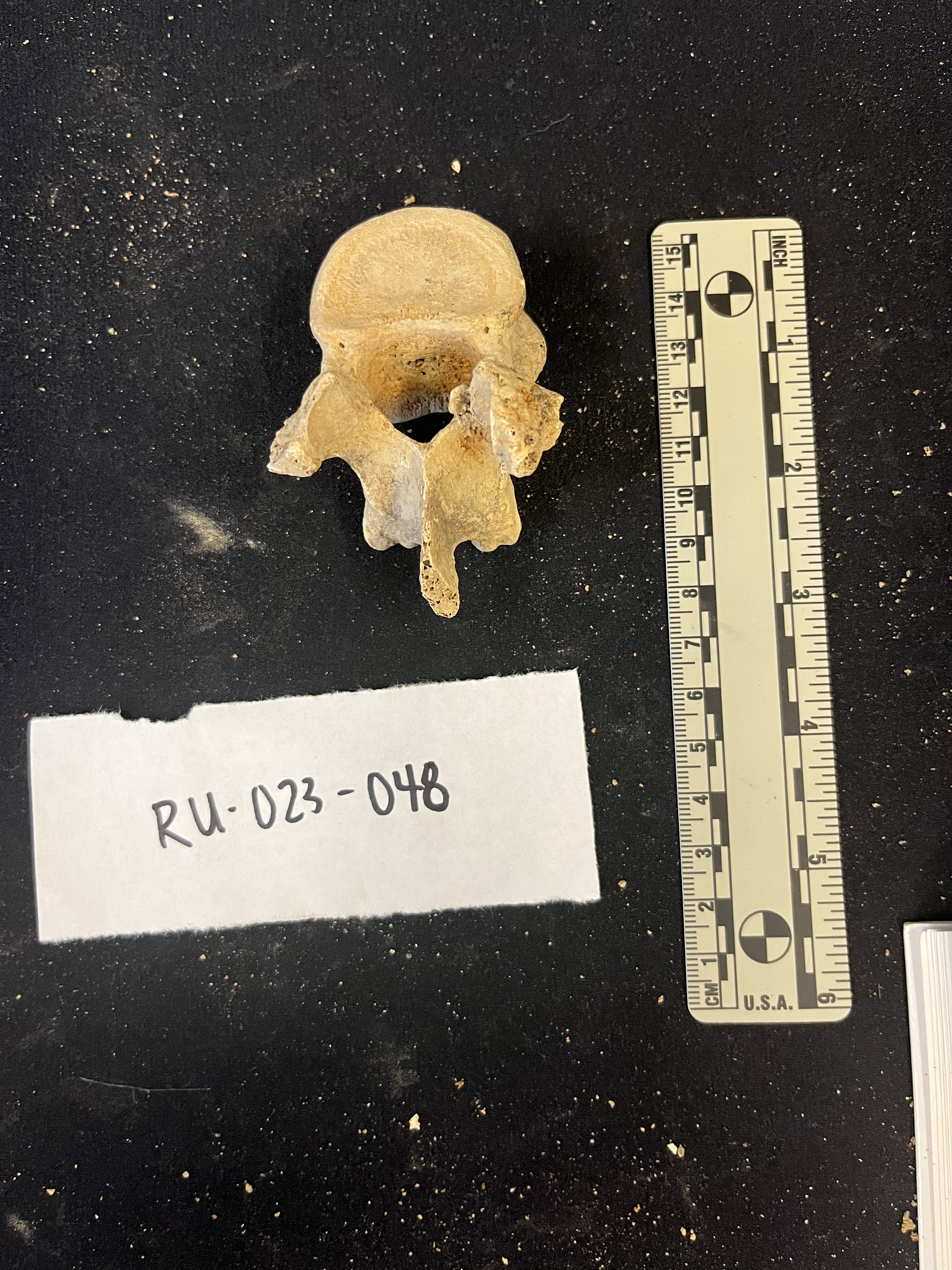thoracic vertebrae