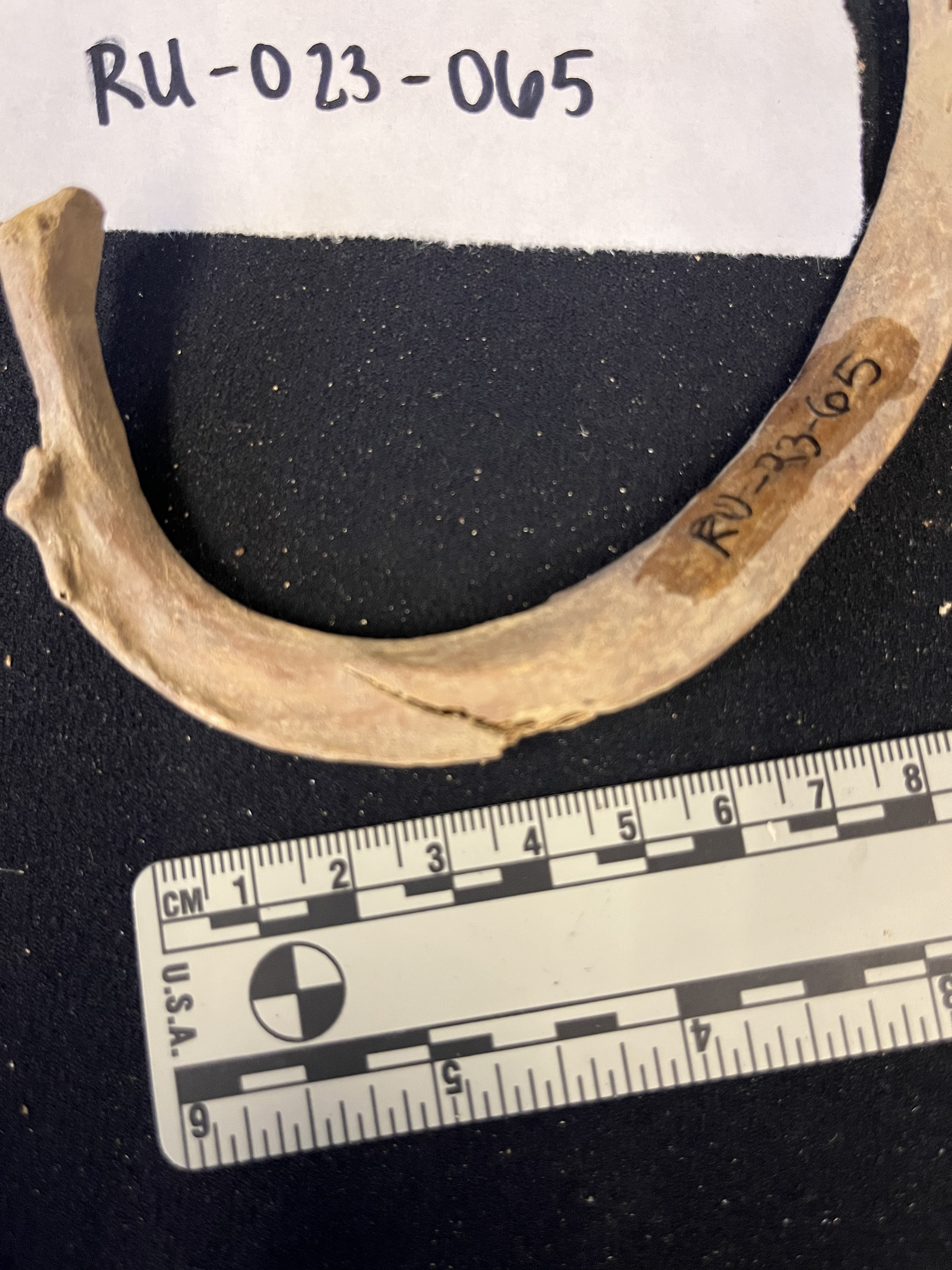 1st left rib postmortem damage