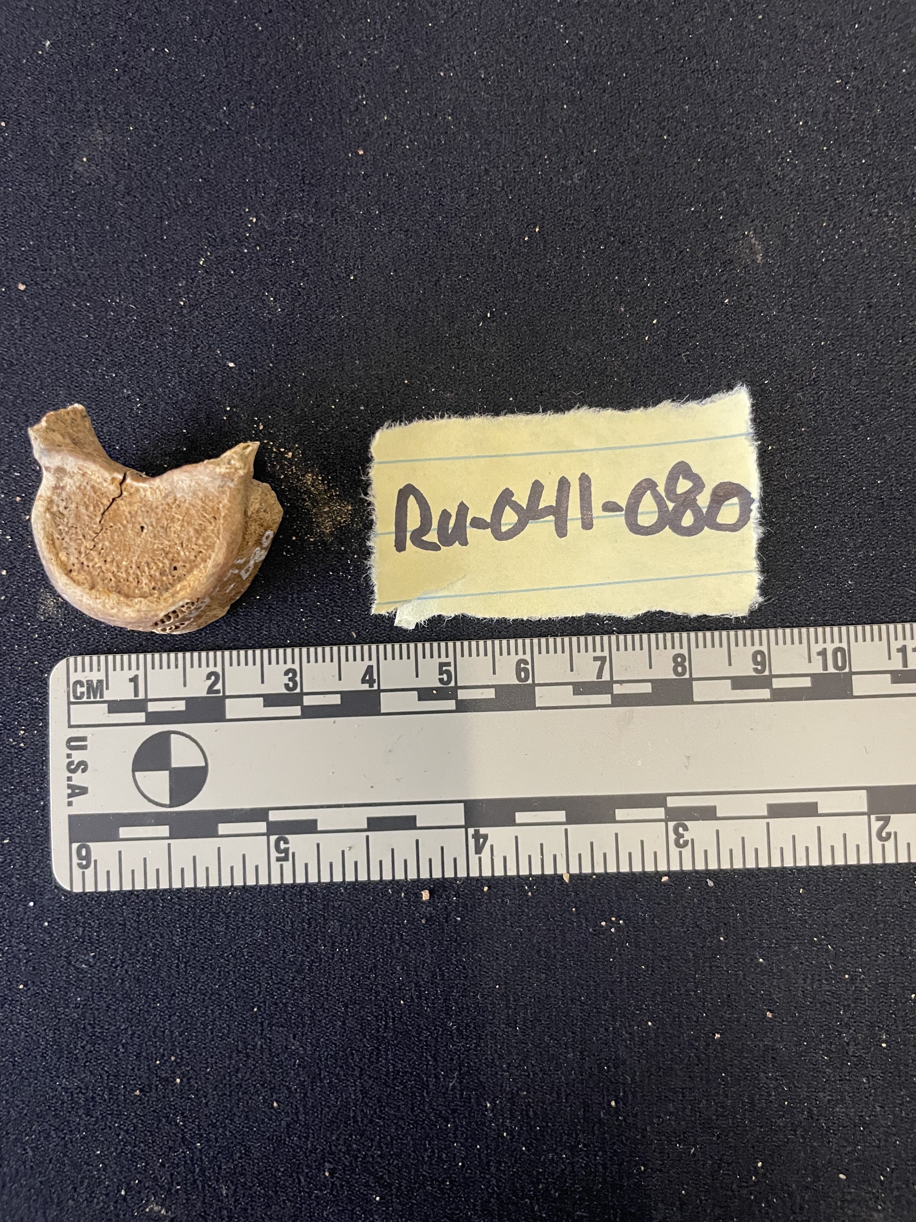 Thoracic Vert 
